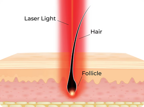 Laser Light Image